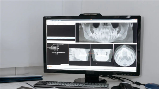 What is a Medical Display and Why It Matters in Healthcare